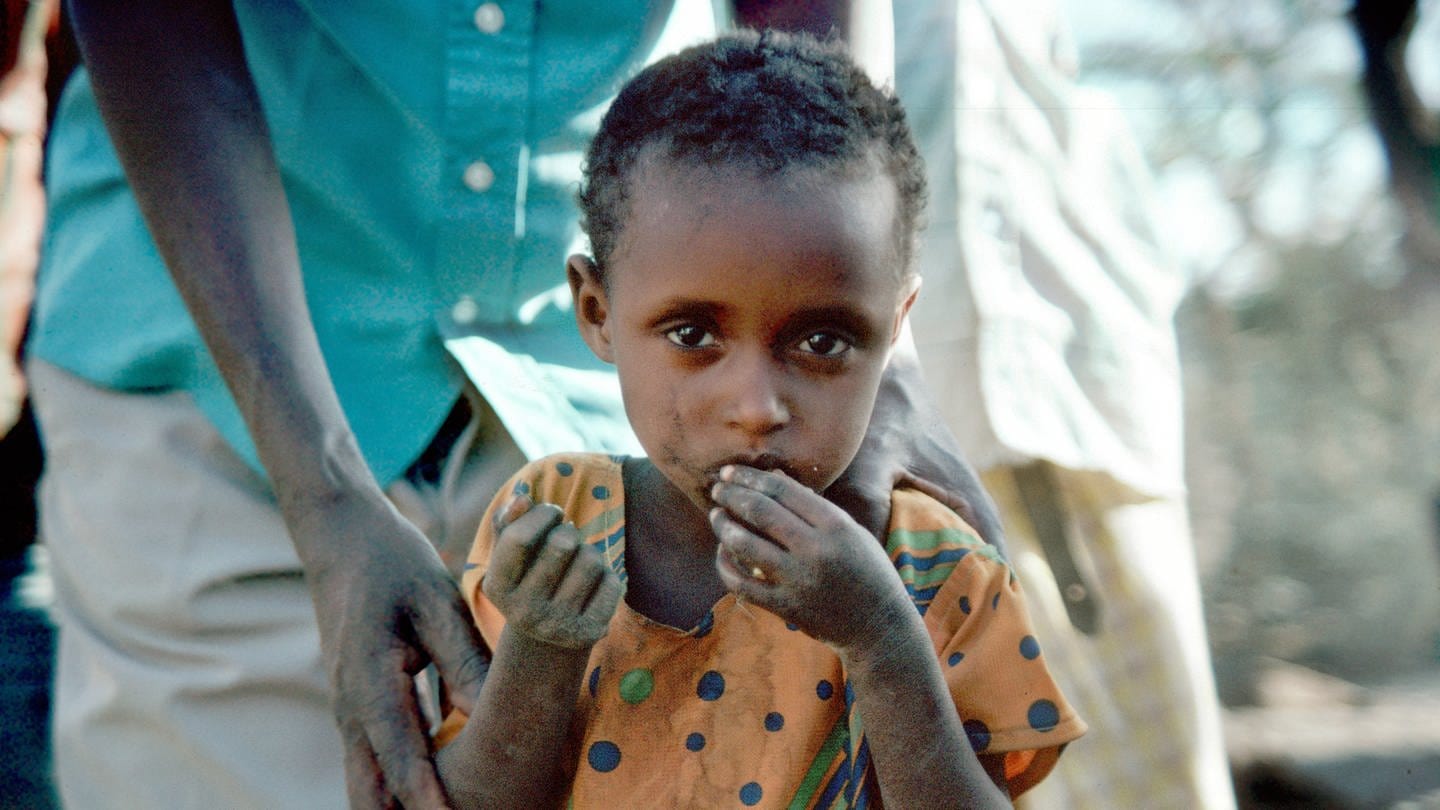 Ein Kind isst in einem Flüchtlingslager im Süden von Somalia. Laut UNICEF leidet jedes vierte Kind weltweit an Ernährungsarmut.