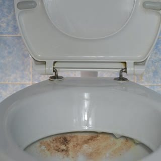 Symbolbild dreckige Toilette